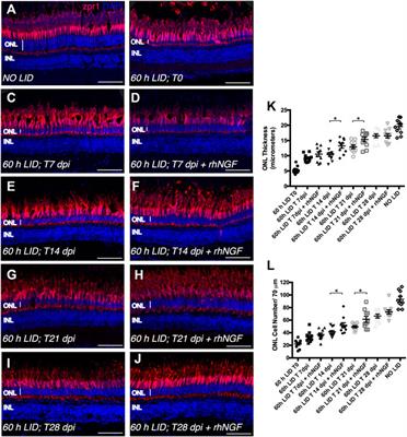 Intravitreal Administration of rhNGF Enhances Regenerative Processes in a Zebrafish Model of Retinal Degeneration